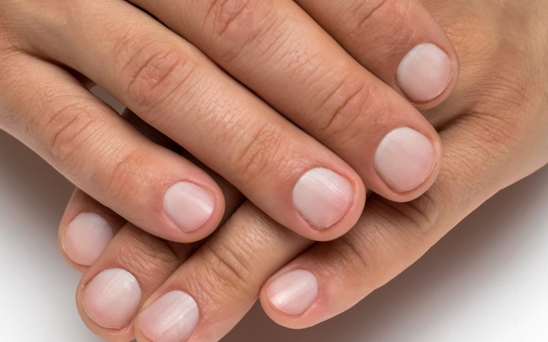 A man's hands show healthy fingernails with a natural pink color and smooth texture against a white background.